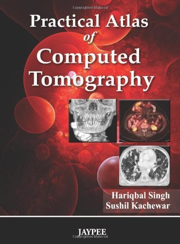 Practical Atlas of Computed Tomography 1st Edition by Singh, Hariqbal, M.D., Kachewar, Sushil, M.D. (2010) Gebundene Ausgabe