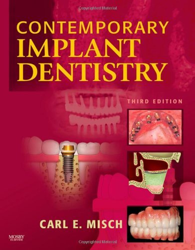 Contemporary Implant Dentistry, 3e by Carl E. Misch DDS MDS PHD(HC) (4-Feb-2008) Hardcover