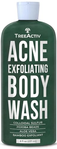 TreeActiv Acne Exfoliating Body Wash, 8oz, Foam Cleanser for All Skin Types, Sulfur, Aloe Vera, Jojoba Beads